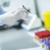 Uputstva za sakupljanje fecesa (stolice) za mikrobiološka ispitivanja