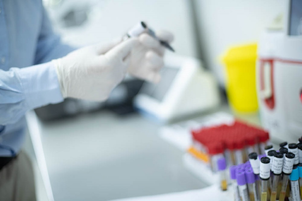Analiza fecesa u Aqualab laboratoriji